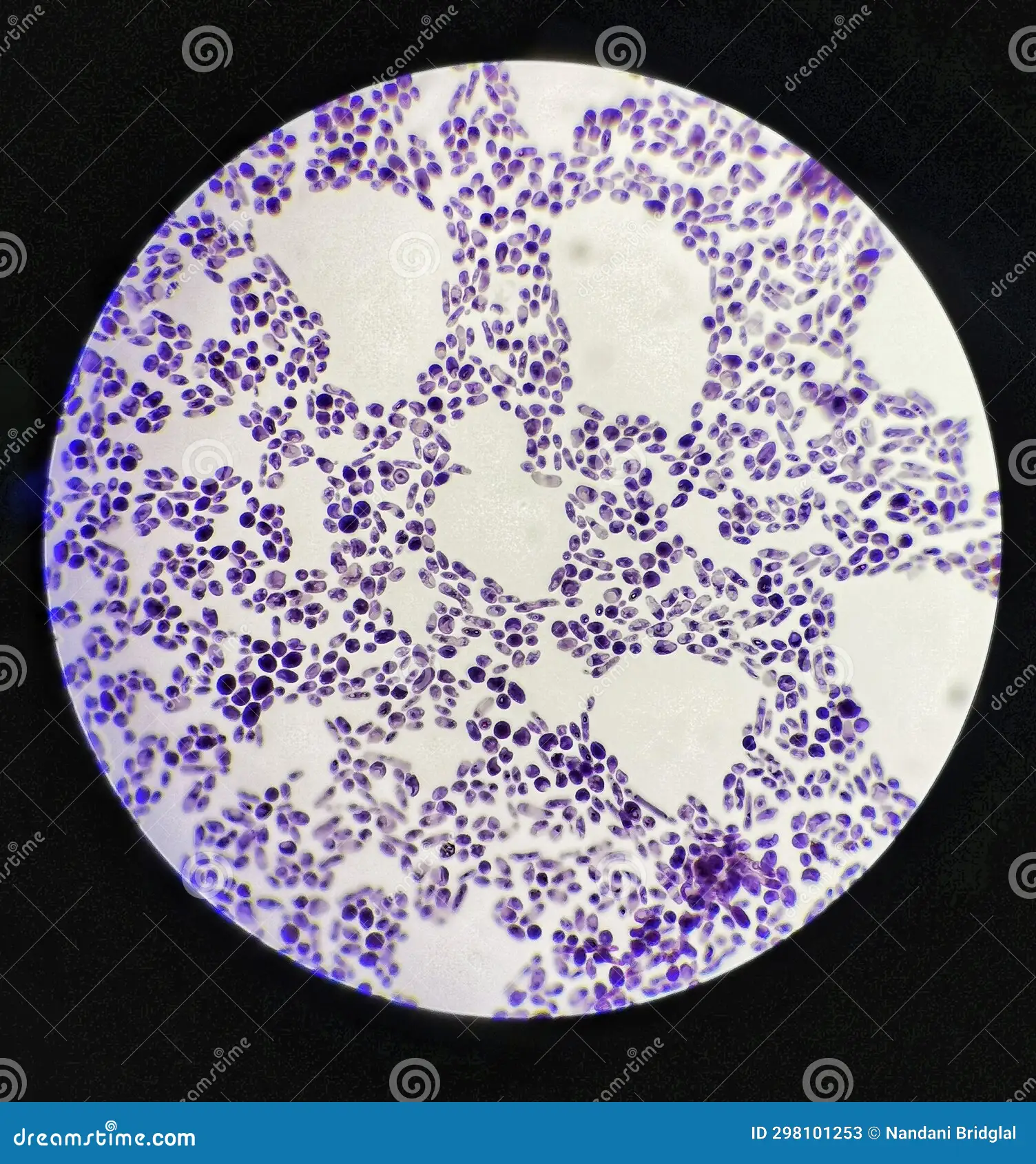 <p>Yeast</p><p><u>Cell morphology</u><strong>: cocci</strong> but also can be <strong>bacilli </strong></p><p>4) <u>Gram-stain</u>: <span style="color: green;"><strong><mark data-color="purple" style="background-color: purple; color: inherit;">positive</mark></strong> </span>(purple)</p>