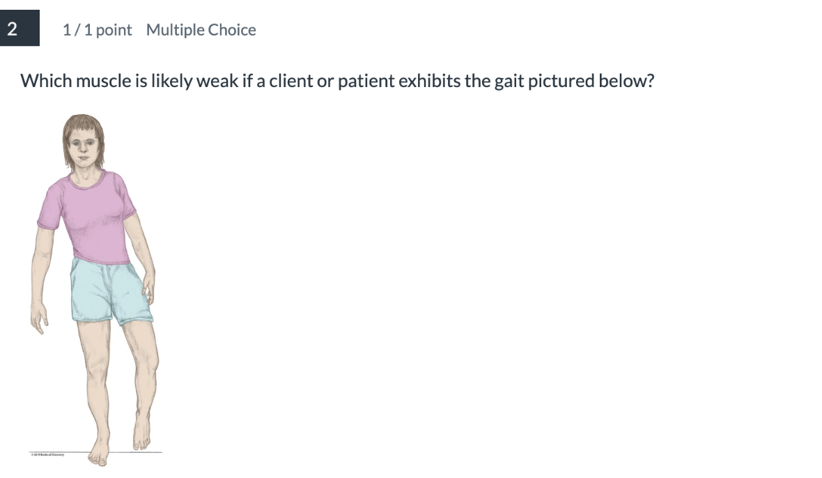 <p><span>Which muscle is likely weak if a client or patient exhibits the gait pictured below?</span></p>
