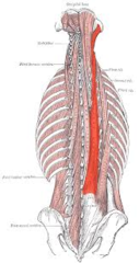 <p>posterior, lateral to spinalis</p>