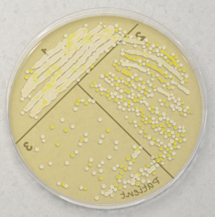 <p>Which is the lowest-numbered sector that contains well-separated isolated colonies?</p>