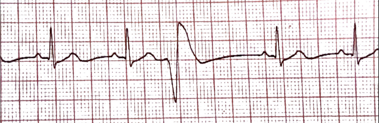 <p>What rhythm is this + bpm</p>
