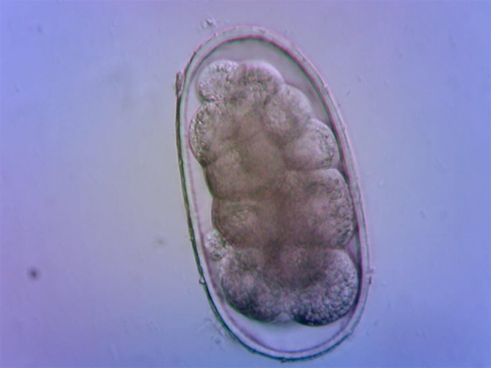 <ul><li><p>Hookworms and lungworms </p></li><li><p>Thin-shelled and smooth-walled eggs </p></li><li><p>Parelaphostrongylus tenuis is the meningeal worm found in moose, elk and deer </p></li><li><p>Treatment is with fenbendazole or ivermectin </p></li></ul><p></p>