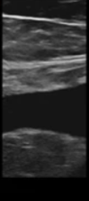<p>is the probe longitudinal or transverse</p>