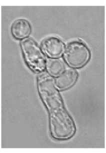 <p>Basic view of specimen with a refracted light source scaled with a condenser lens shining under the specimen </p>