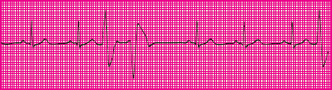 <p>Which rhythm is this?</p>