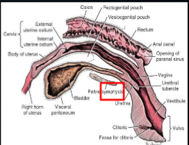 <ul><li><p>Two cavities</p><ul><li><p>Caudal: vestibule</p></li><li><p>Cranial: vagina</p></li></ul></li><li><p>Urethral opening is on ventral vestibule floor</p></li><li><p>Vestibular-vaginal junction feels like a round thickening that narrows</p></li></ul><p></p>