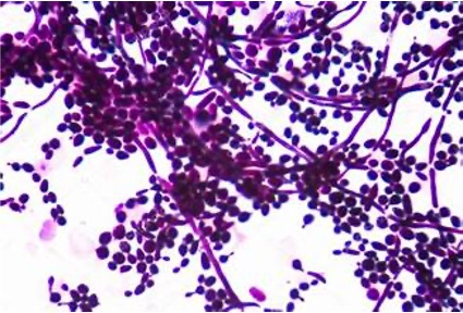 <p>Long filaments with budding all around, reproduce through asexual budding</p>