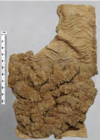 <p>Identify the POT</p>