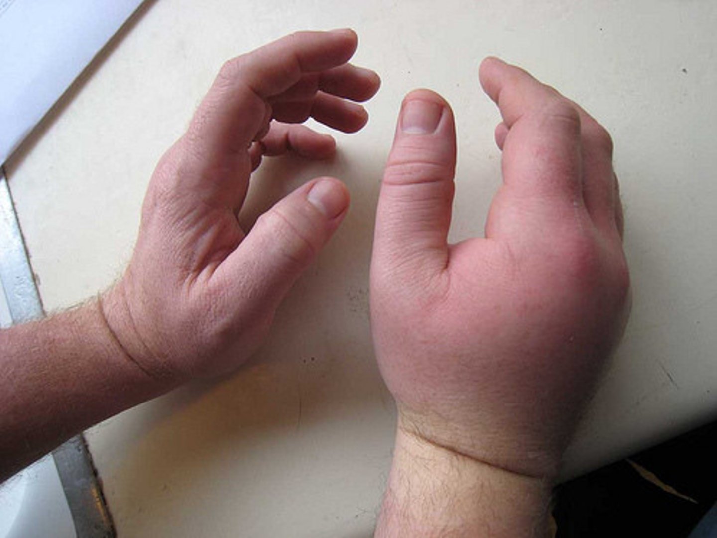 <p>to become larger, to increase</p>