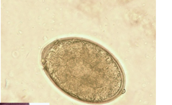 <p>-Are smooth with shoulderless operculum and small knob</p><ul><li><p>Around 60 microns</p></li></ul><p></p>