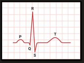 <p>4 Events - 3 visable </p><ol><li><p>Arterial depolarisation (P wave)</p></li><li><p>Ventricular depolarisation ( Masks atrial repolarisation) ( QRS)</p></li><li><p>Ventricular repolarisation ( T wave)</p></li></ol><p></p>