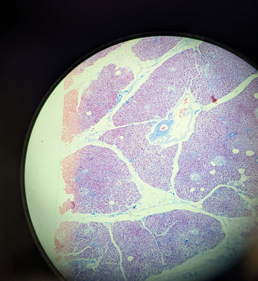 <p>Where in the body is this</p>