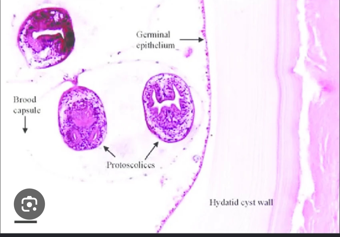 <p><span>Echinococcus granulosus</span></p>