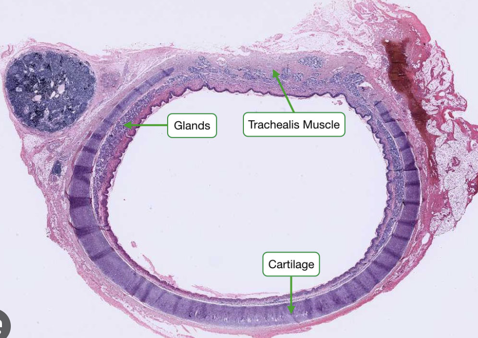<p>Trachealis muscle </p>
