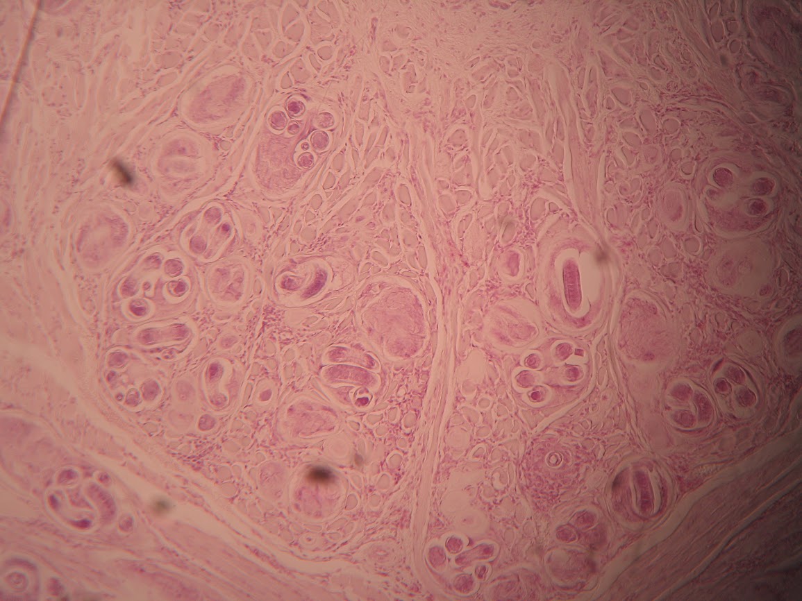 <p><span>This parasite is transmitted by eating contaminated under cooked pork: T/F</span></p>