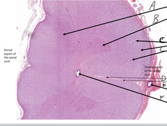 <p>What is indicated by the arrow labeled 'A' in this slide of spinal cord?</p>