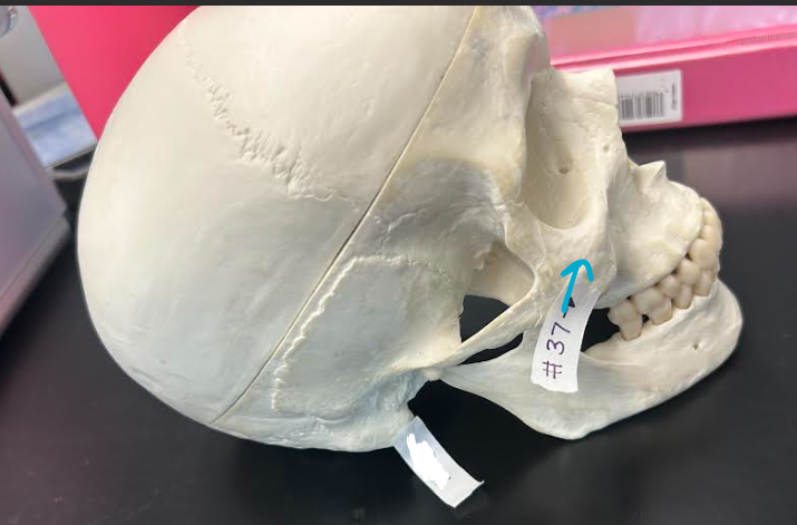 <p>ID skull region</p>