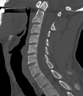 <p>what is the diagnosis?</p>