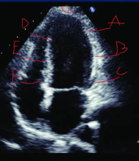 <p>What segment is at F? </p>