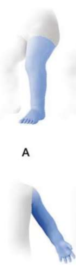 <p>this limb deficiency would be considered ___________</p>