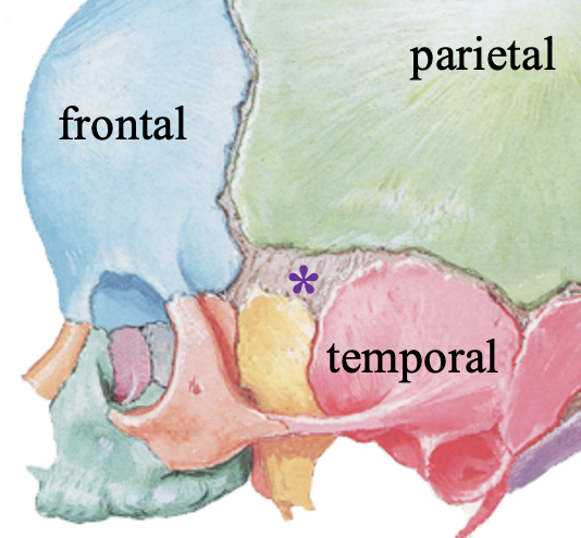 <ul><li><p>located b/t frontal, parietal, sphenoid, and temporal bones</p></li><li><p>closes at 6 months </p></li></ul><p></p>