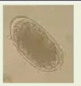 <p>Identify</p>