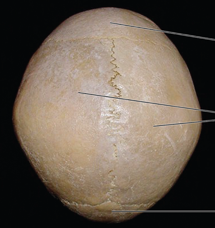 <p>Outer side of wall of hollow structure</p>