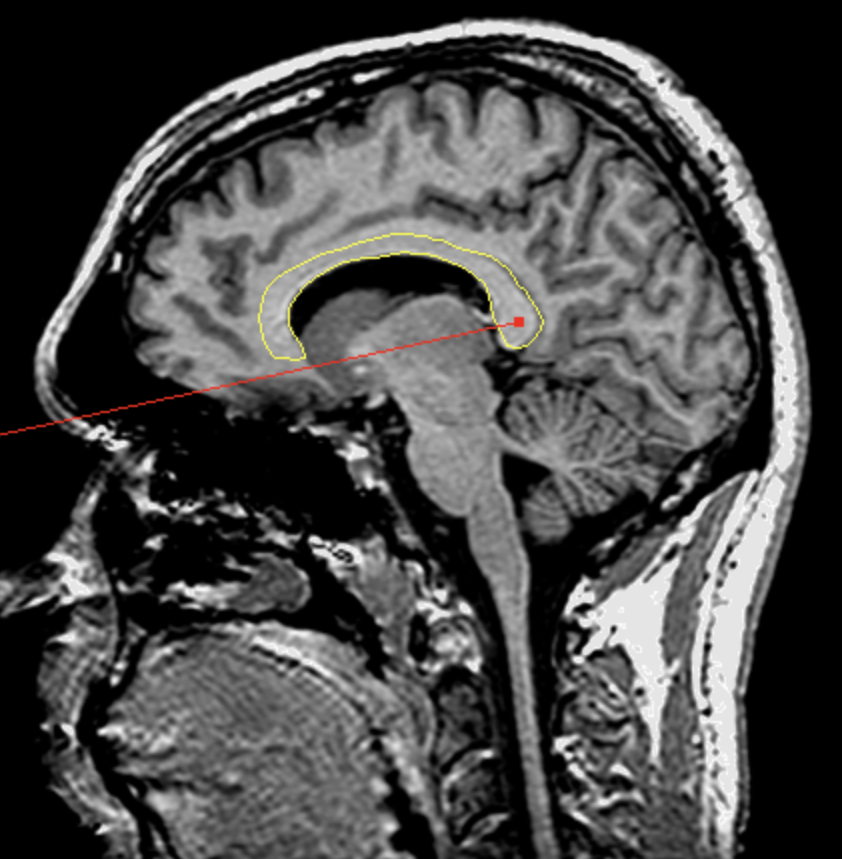 <p>What is the area highlighted called?</p>