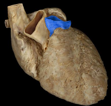 term image