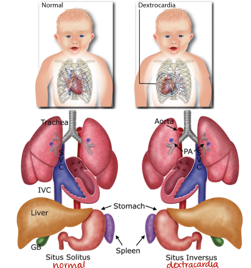 <p>how the organs are arranged in the fetus</p>