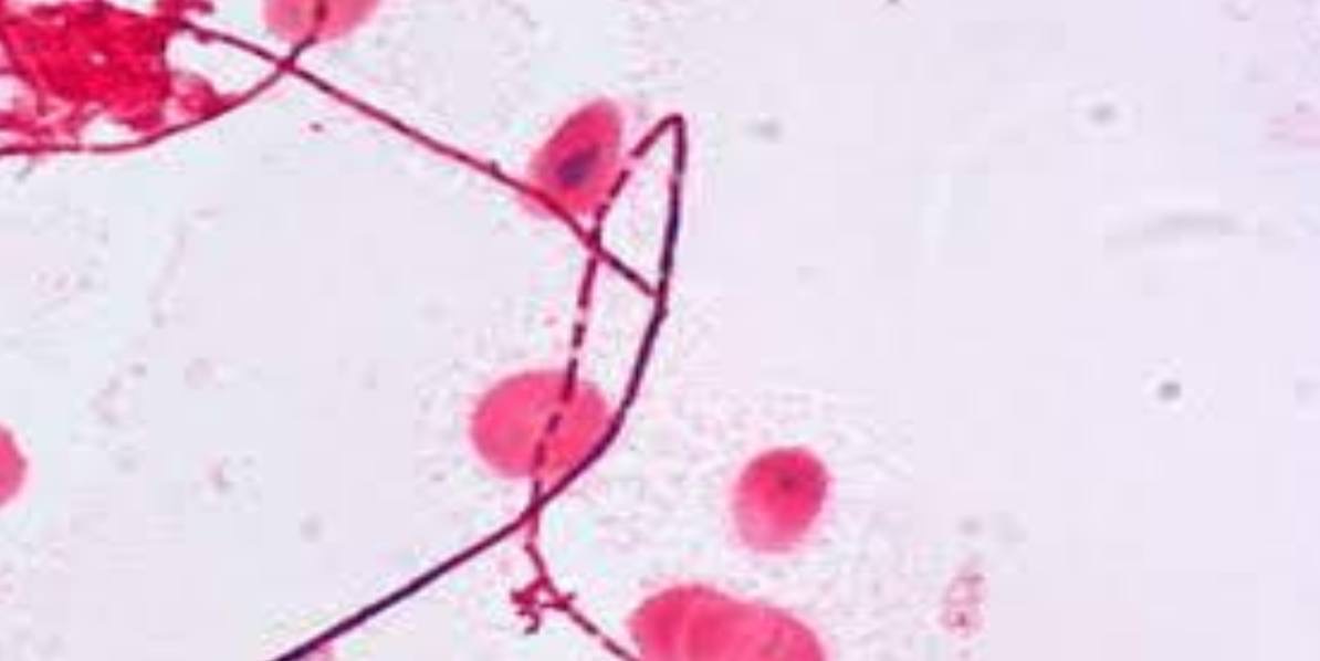 <p>Specimen (microscopically slide):</p><p>• Name of organism:</p><p>• Stain:</p><p>• Sample from: culture or pus or in tissue</p><p>• Morphology</p>