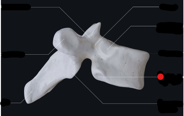 <p>Identify the structure pinned and what thoracic vertebrate it links to </p>