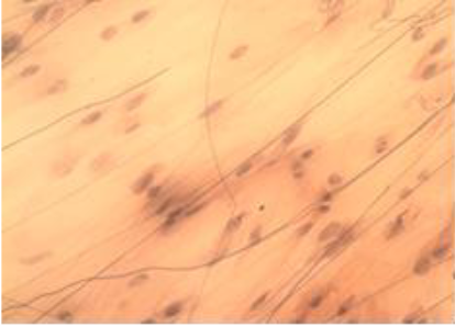 <p>areolar tissue</p>