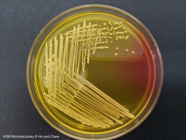 <p>forms <mark>smooth, round, convex colonies that range from 1 to 4 mm in diameter</mark>. The colonies have a glistening, buttery consistency, a well-defined edge, and are most famously known for their distinct golden-yellow pigmentatio</p>