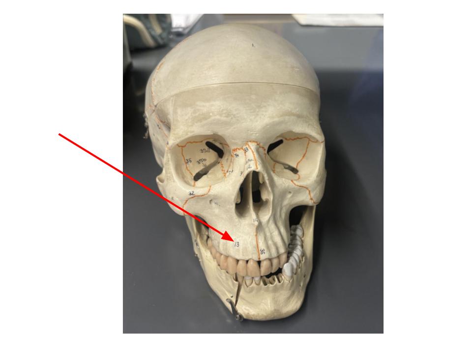 <p>upper jaw</p>