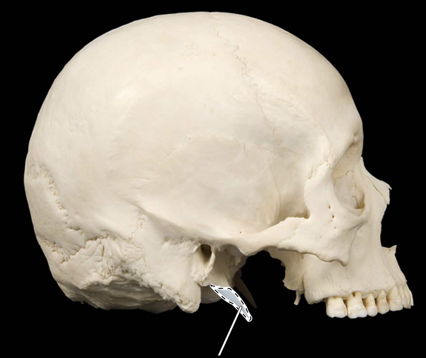 knowt flashcard image