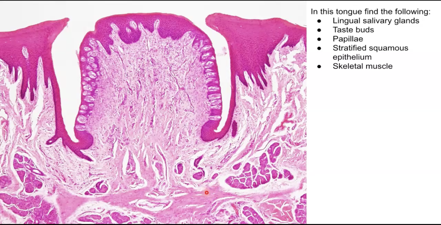 <p>Identify the following: </p><p>Lingual salivary glands</p><p>Skeletal muscle</p><p>Taste buds</p><p>Papillae</p>