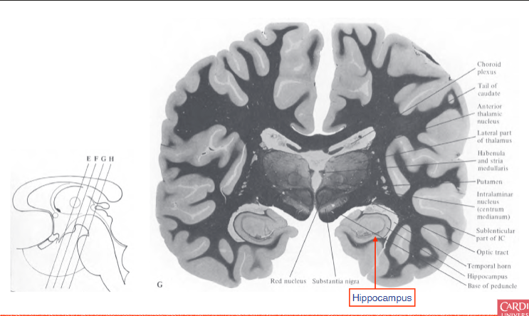 <p>found posteriorly to the amygdala, involved in encoding declarative memories</p>