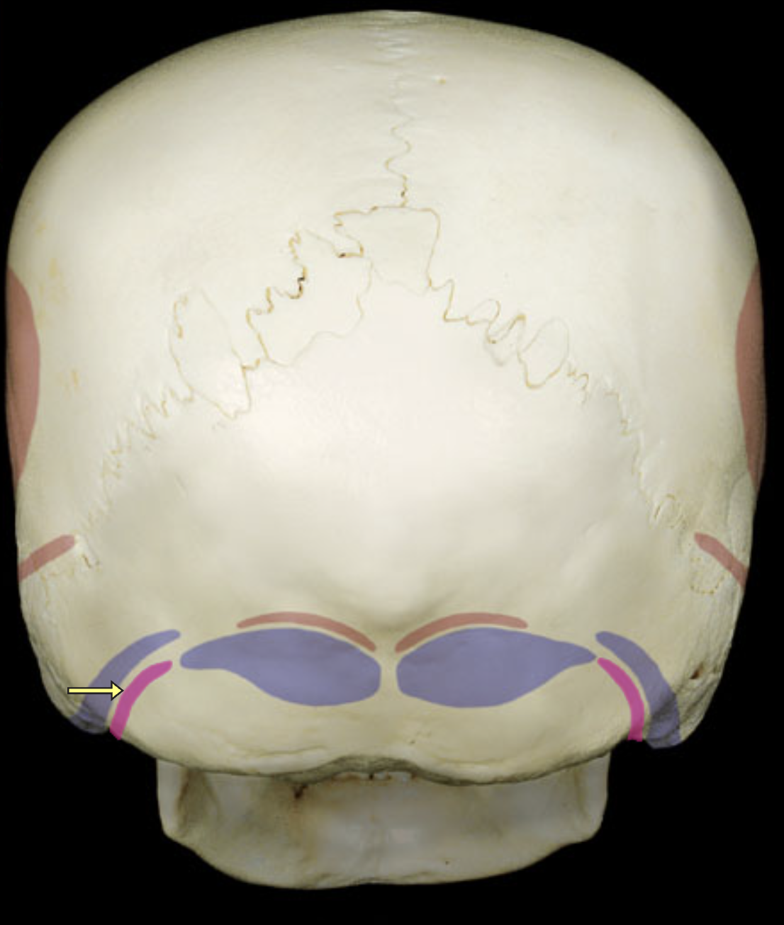 <p>(pink highlight)</p>