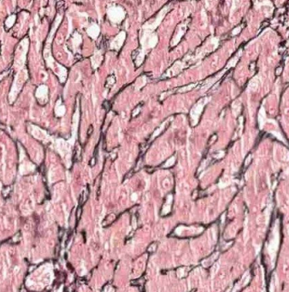 <p>reticulin</p>