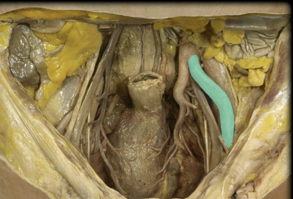 <p>Identify the feature of the abdominal aorta</p>