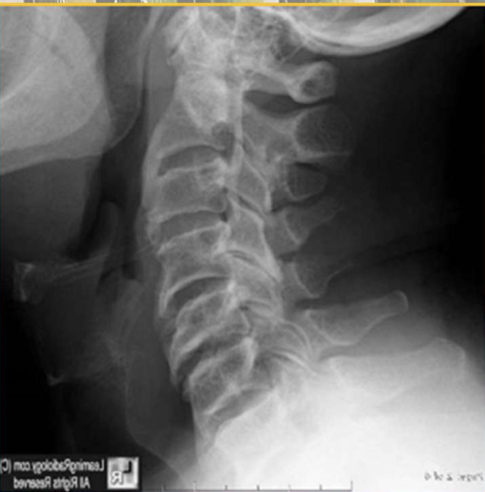 <p>What three DDx could you give this patient</p>