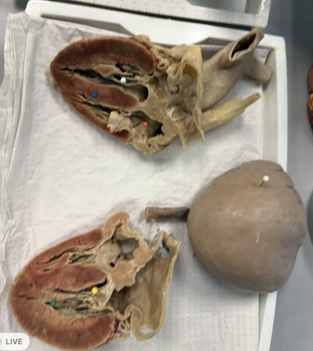 <p>What is the structure of the yellow pin?</p>