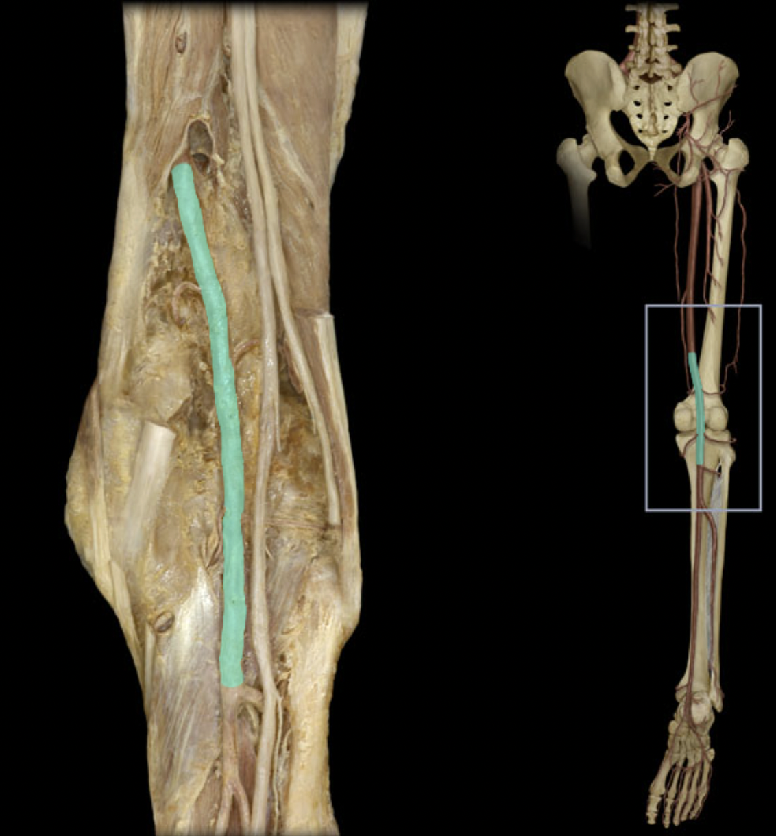 <p>Identify the blood vessel of the lower extremity</p>