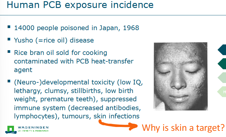 <ul><li><p>Skin because skin is fat</p></li></ul><p></p>