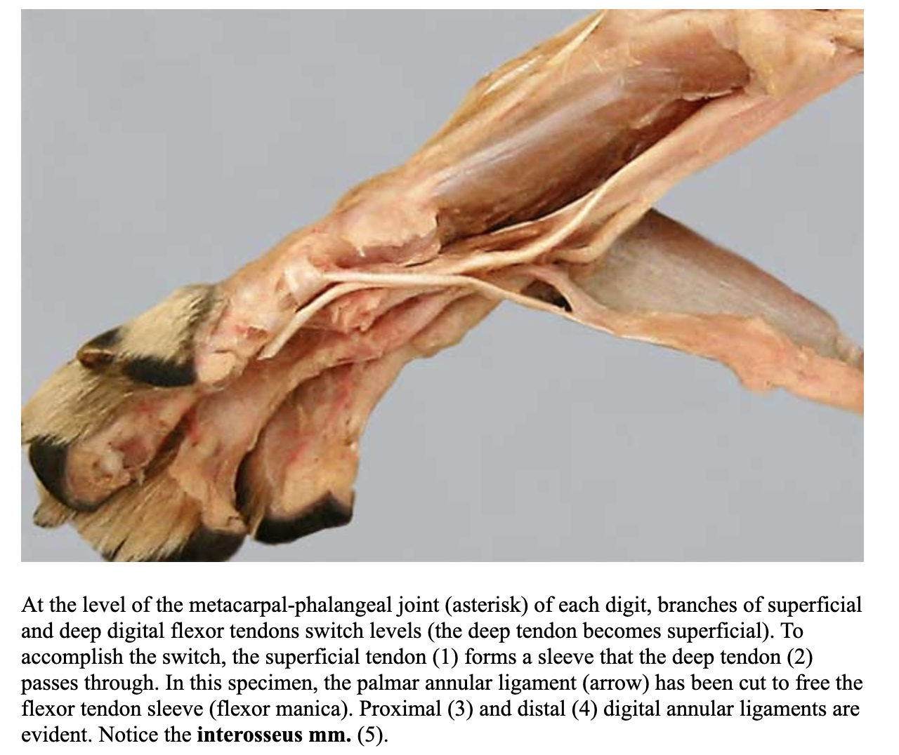 <p>tubelike enclosures formed by tendons of the superficial digital flexor m. around the deep digital flexor tendons at the level of the metacarpophalangeal joints, allowing the deep digital flexor tendons to “perforate” the superficial digital flexor tendons and assume a more superficial postion </p>