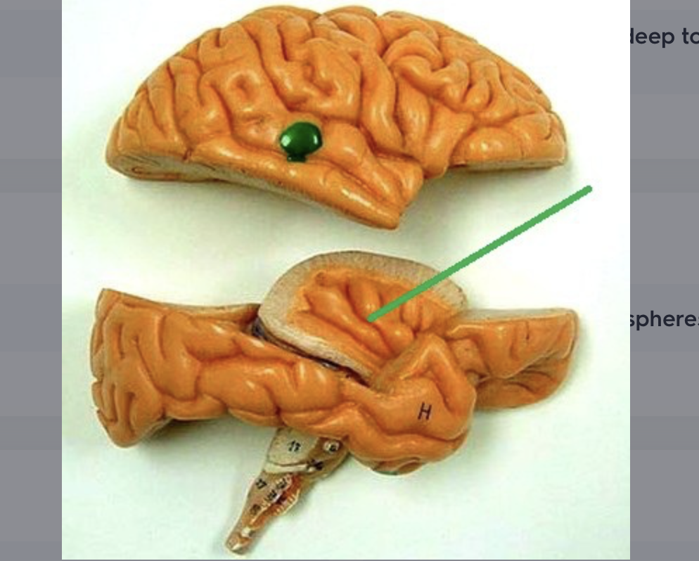 <p>cortical lobe “hidden” deep to lateral sulcus; location of gustatory cortex</p>