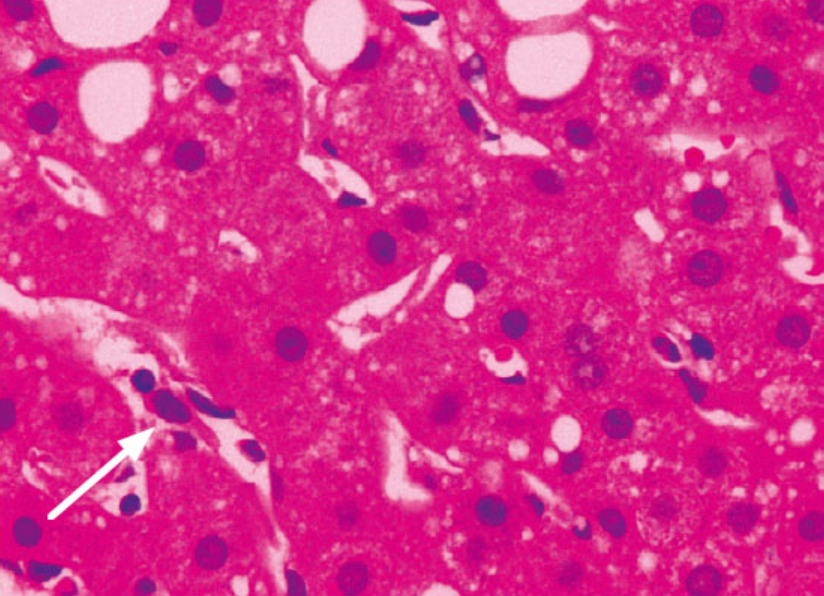 <p><span style="font-family: "Times New Roman", serif; line-height: 115%;"><span>Dentro de sinusoides hepáticos existen</span><strong><span> células especializadas de sistema inmunológico</span></strong><span> </span></span><span style="font-family: "Times New Roman", serif; line-height: 115%; color: red;"><strong><span>encargadas de eliminar eritrocitos envejecidos y otras partículas circulantes</span></strong></span><span style="font-family: "Times New Roman", serif; line-height: 115%;"><span>: ¿Cuales?</span></span></p>