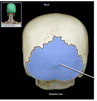<p>What structure is indicated</p>