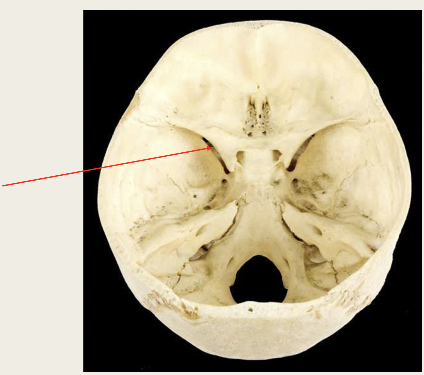 <p>Abducens</p><p>Nerve (VI)</p><p>■ Function: XX XX (XX)</p><p>■ Passes through XX XX XX</p><p></p>